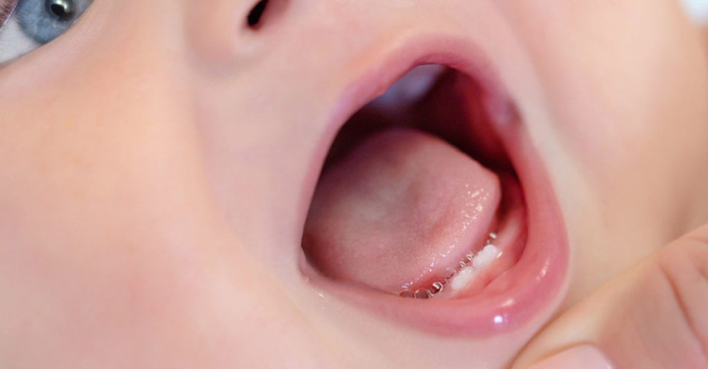 Anzeichen fürs Zahnen beim Baby