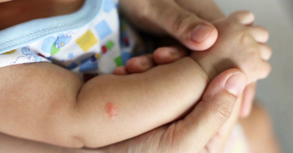 Insektenstiche und Zeckenbisse bei Kindern