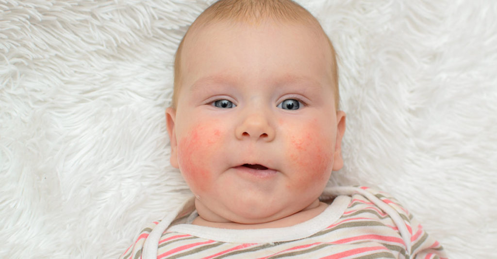 Immunsystem und Allergien bei Kindern