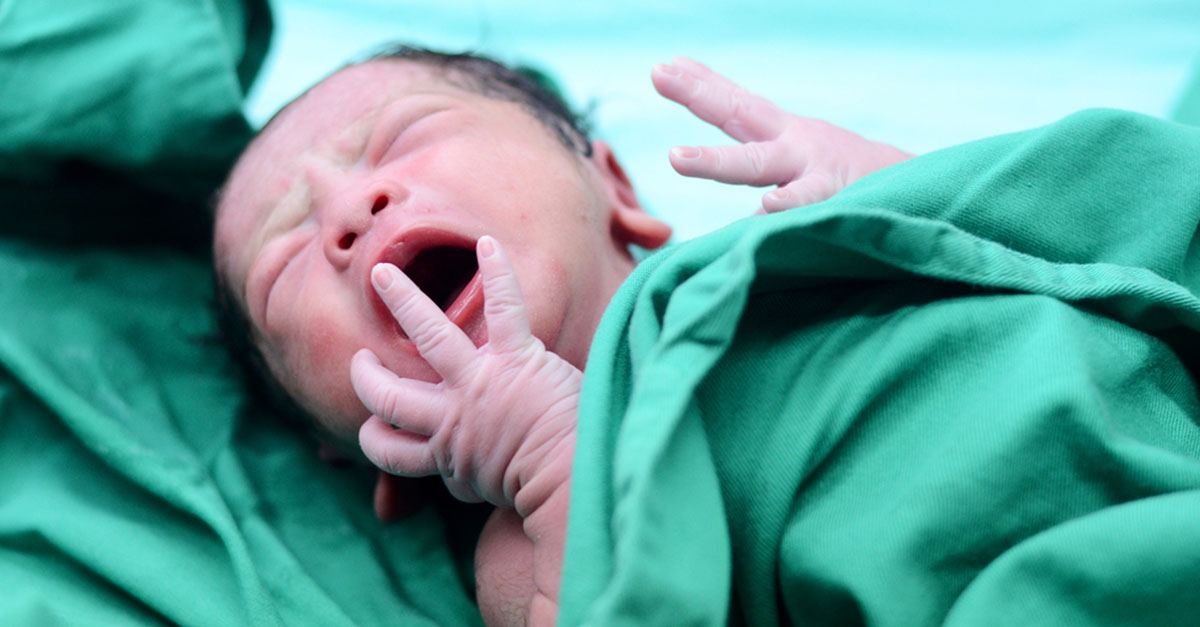 Käseschmiere beim Baby