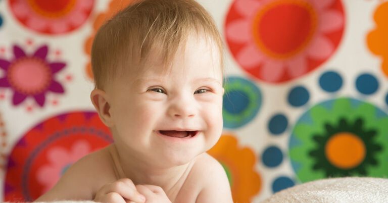 Trisomie 21 Ohne äußere Merkmale www.baby.at