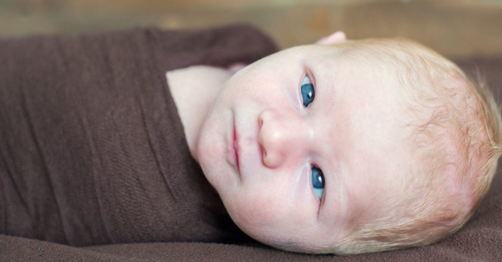 Strabismus