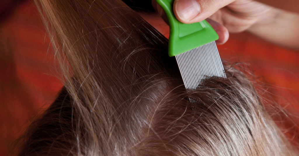 So erkennen Sie Läuse bei Kindern