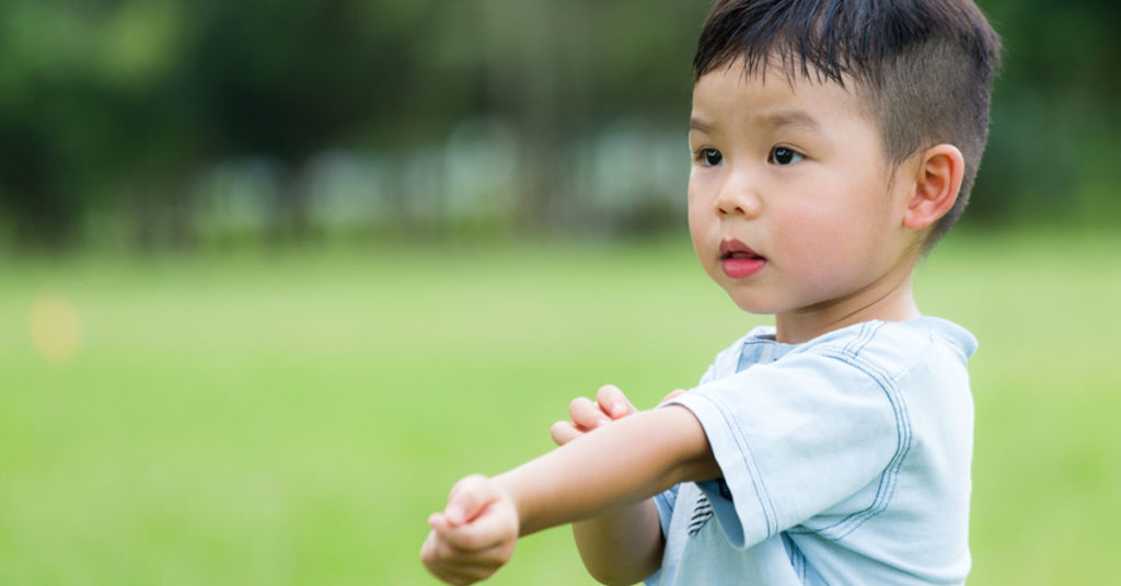 Neurodermitis bei Kindern