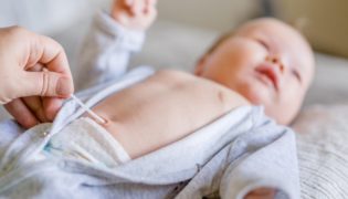 Nabelpflege und Nabelinfektion